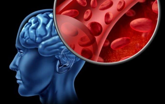 Faim d'oxygène du cerveau