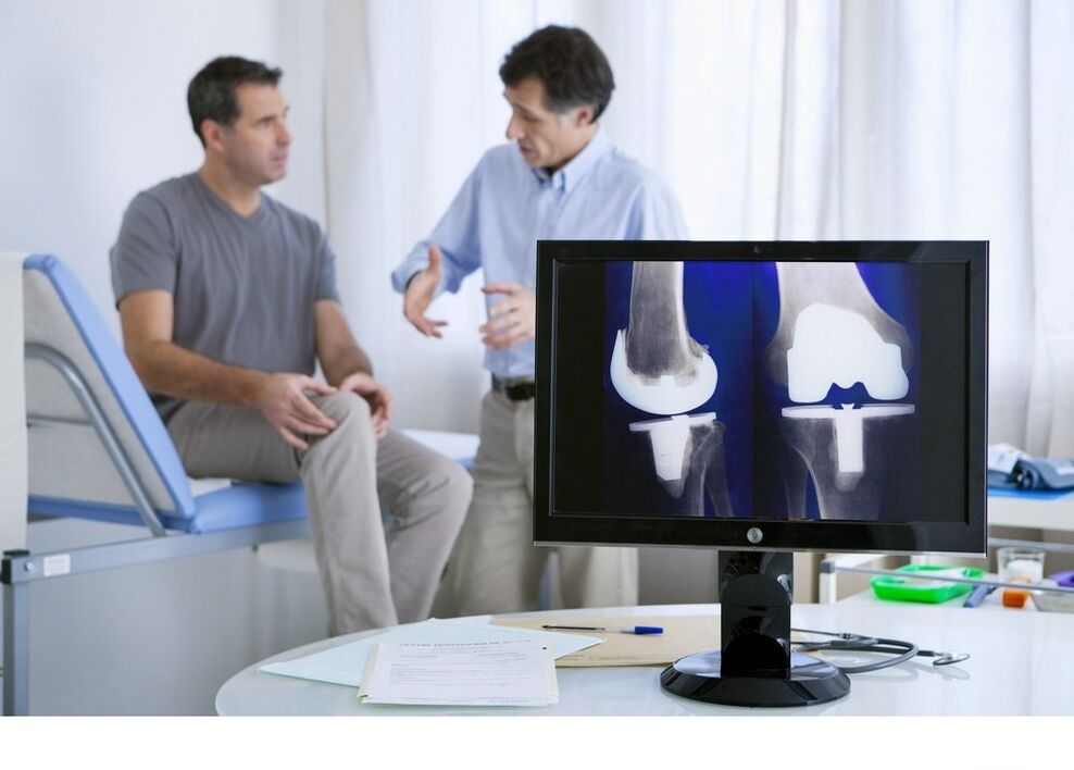 Arthrose de l'articulation du genou dans l'image x-rayage